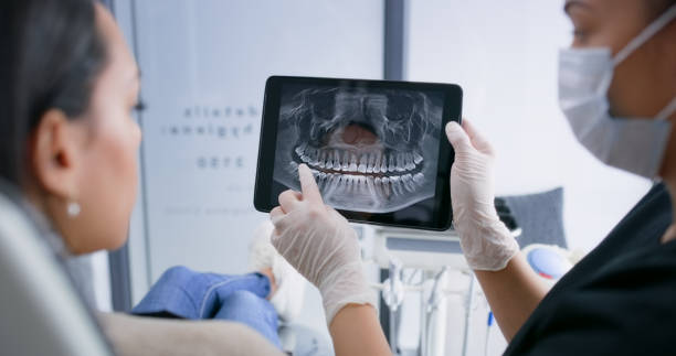 Licensed Tooth Extraction service in Lincoln, IL - Smile Center Dentistry